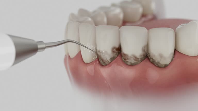 Trusted Teeth Whitening service in Farmersville, OH - Dentist Open Now